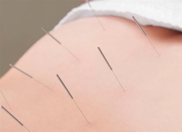 河北省郭氏按摩職業(yè)培訓(xùn)學(xué)校中醫(yī)針灸推拿專業(yè)培訓(xùn)班開課了嗎？